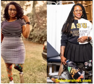 Lady who lost  both legs to accident, becomes first medical doctor with disability in the U.S